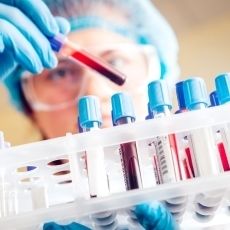 Sarcopenia: una complicación crónica en Diabetes mellitus tipo 2