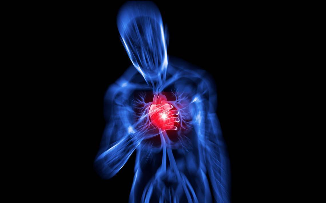 Sarcopenia: una complicación crónica en Diabetes mellitus tipo 2