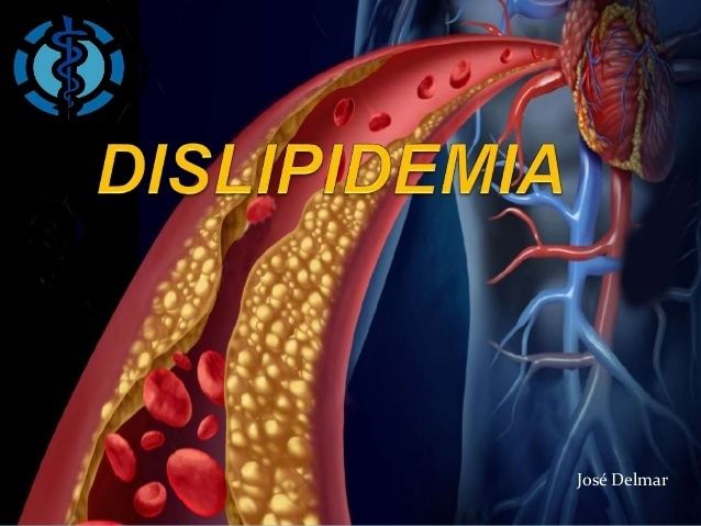 Sarcopenia: una complicación crónica en Diabetes mellitus tipo 2