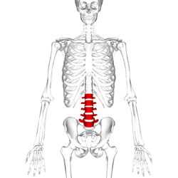 Sarcopenia: una complicación crónica en Diabetes mellitus tipo 2