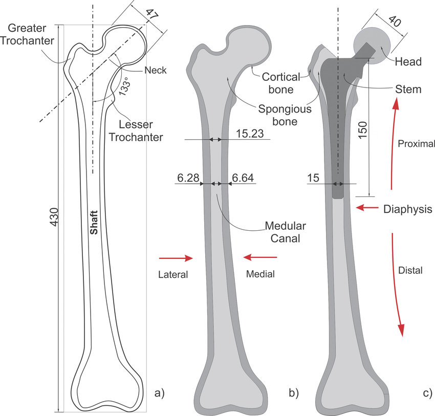 Sarcopenia: una complicación crónica en Diabetes mellitus tipo 2