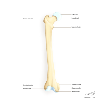 Sarcopenia: una complicación crónica en Diabetes mellitus tipo 2