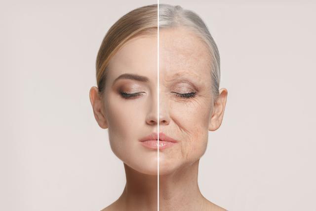 Sarcopenia: una complicación crónica en Diabetes mellitus tipo 2
