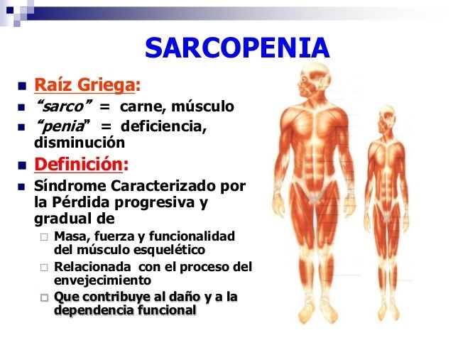 Sarcopenia: una complicación crónica en Diabetes mellitus tipo 2