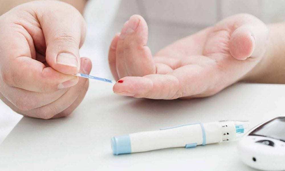 Sarcopenia: una complicación crónica en Diabetes mellitus tipo 2