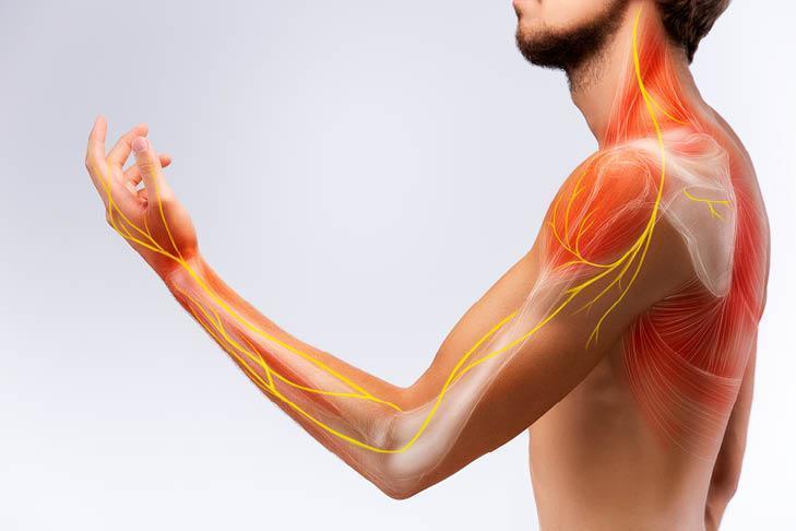 Sarcopenia: una complicación crónica en Diabetes mellitus tipo 2