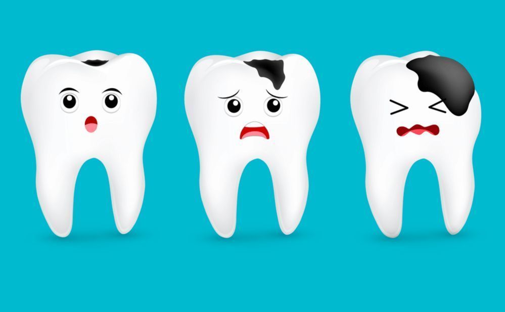 Afecta a los dientes y ocurre cuando las bacterias, el ácido, los residuos de comida y la saliva se mezclan en la boca Se previene cepill...