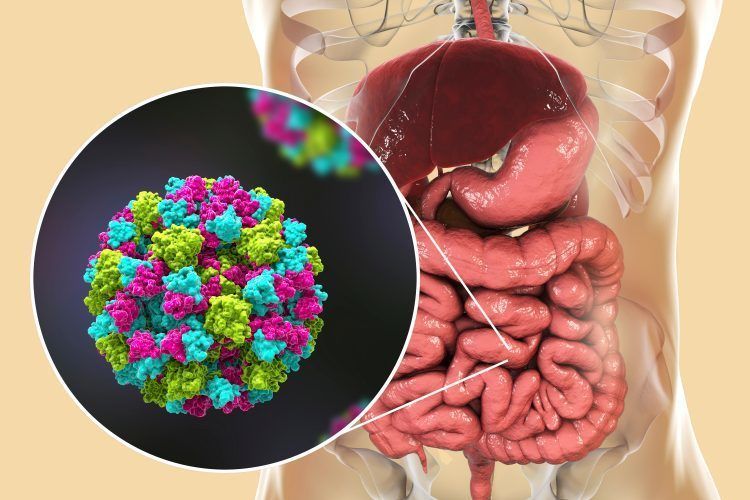 Gastroenteritis Afecta al estómago e intestinos, consiste en una inflamación causada por bacterias Lo más común es el consumo de bebidas ...
