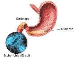 E.coli Enteropatógena 0157:H16 Julie Paola Henao Hurtado UNAD