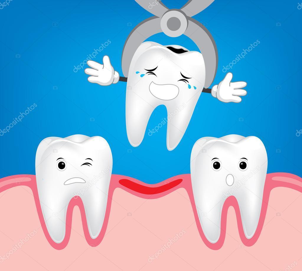 Extracción Dental en Niños