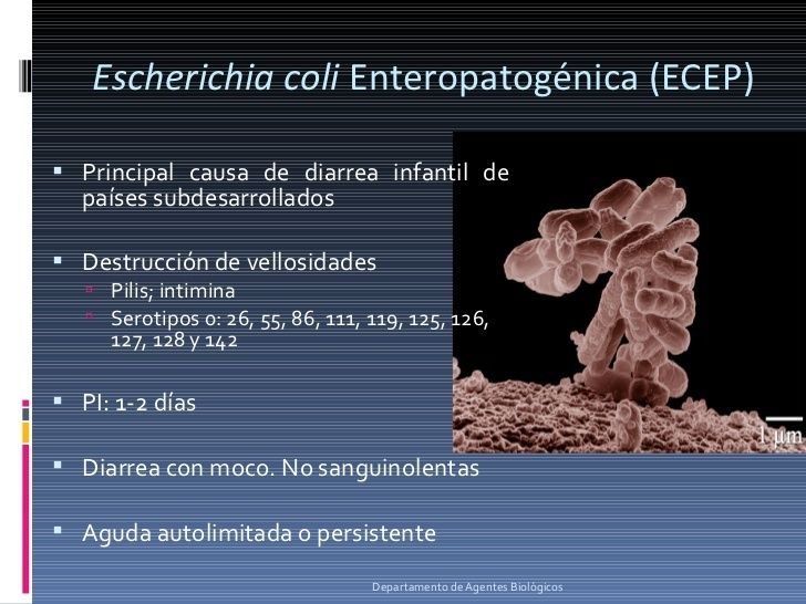 E.coli Enteropatógena 0157:H16 Julie Paola Henao Hurtado UNAD