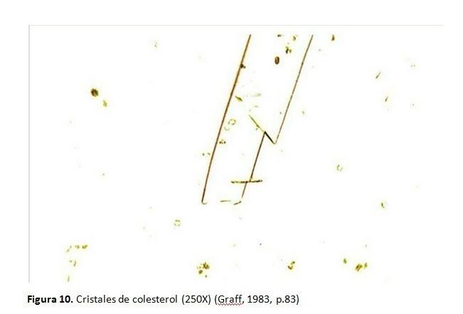 Cristal de colesterol