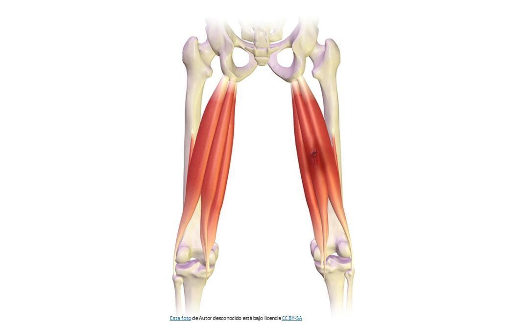 Recto Femoral Es un músculo fusiforme que se reúne con otra zona originada en el canal supracondileo, formando un círculo acintado que oc...