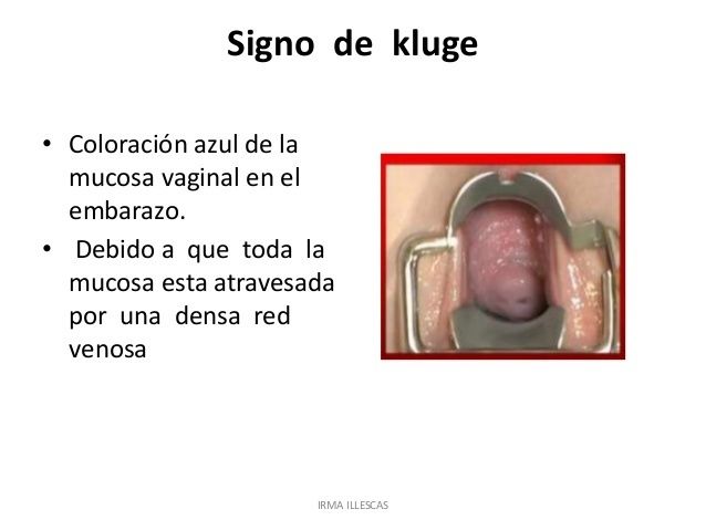Signos y síntomas de presunción, probabilidad y certeza en el embarazo.