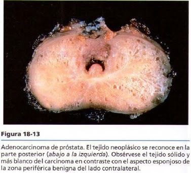 Características macroscópicas: