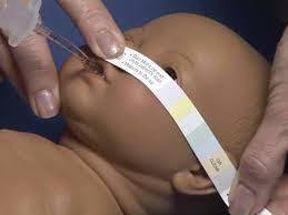 SISTEMA DE FIJACIÓN DE TUBO ENDOTRAQUEAL EN PEDIATRÍA
