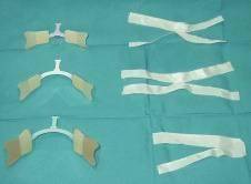 SISTEMA DE FIJACIÓN DE TUBO ENDOTRAQUEAL EN PEDIATRÍA