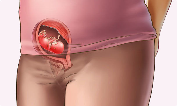 – Características en la mujer: