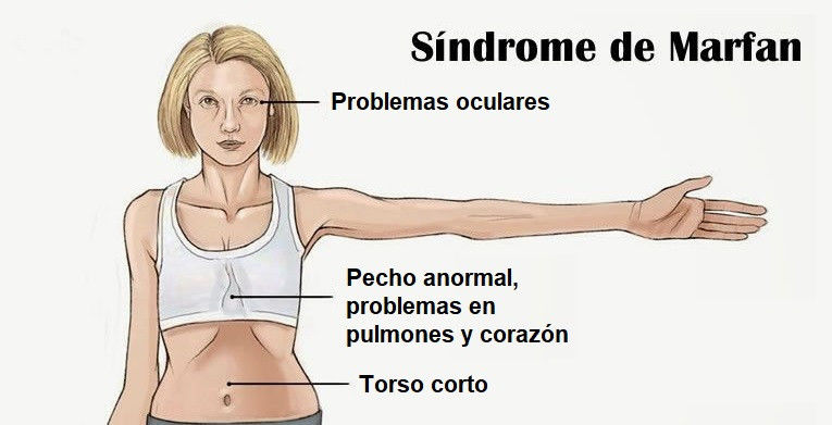 Trastornos del metabolismo de los aminoacidos