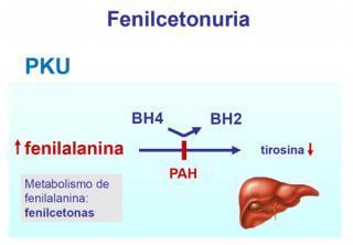 Trastornos del metabolismo de los aminoacidos