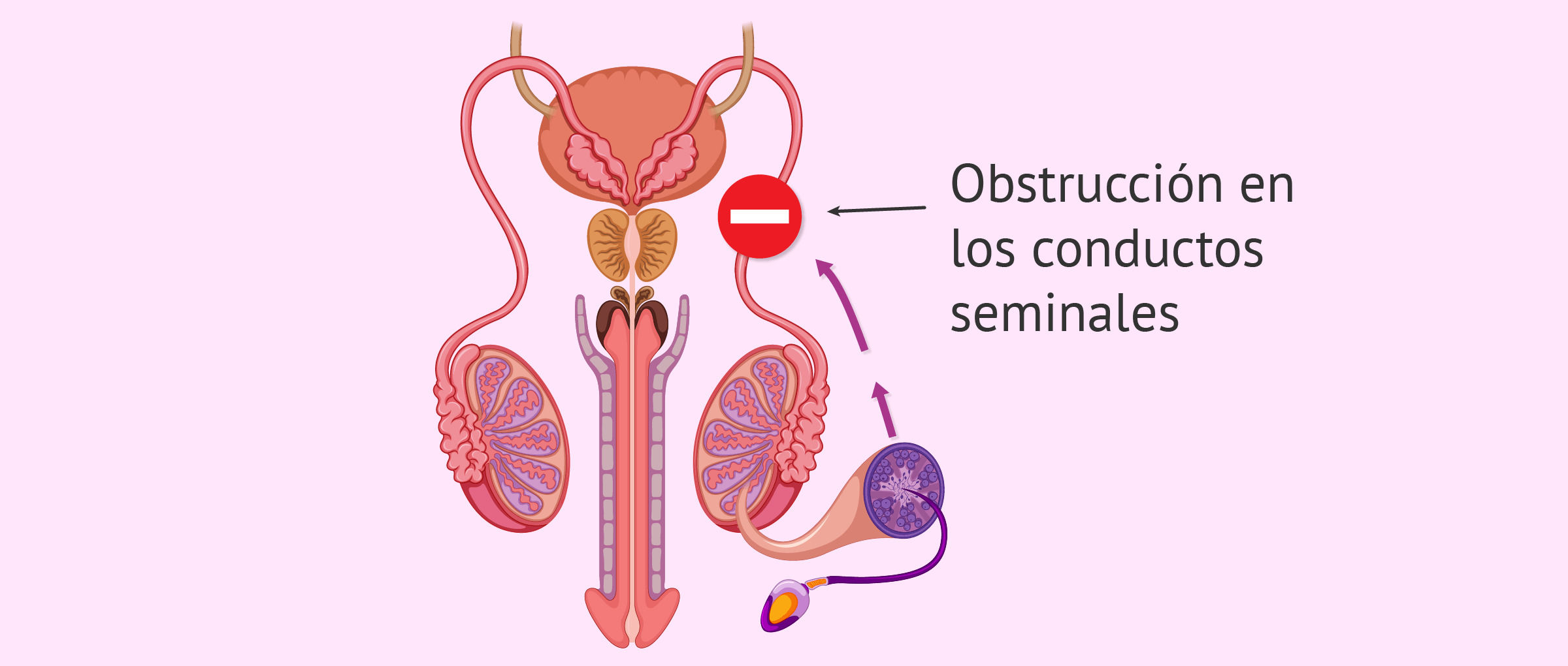 Las Similitudes en Femenino y Masculino
