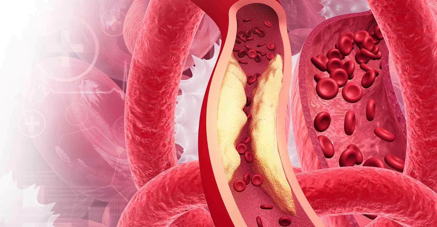 Enfermedades de base en la nutricion