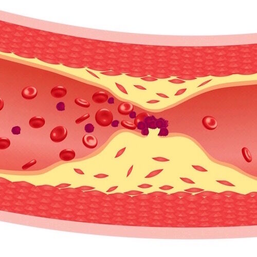 Enfermedades de base en la nutricion