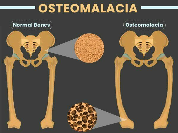 Enfermedades de base en la nutricion