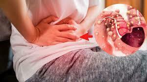 Enfermedades de base en la nutricion