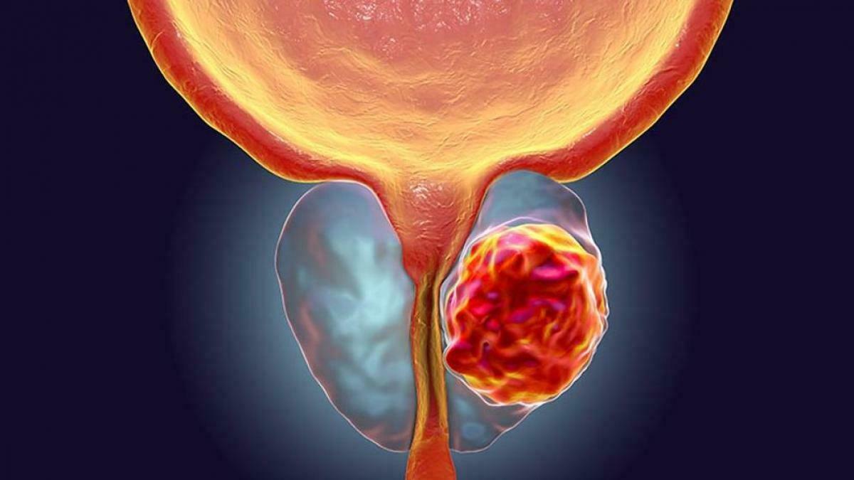 Cáncer y regulación del ciclo celular