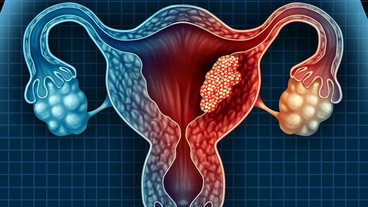 Cáncer y regulación del ciclo celular