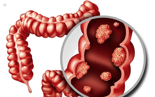 Cáncer y regulación del ciclo celular