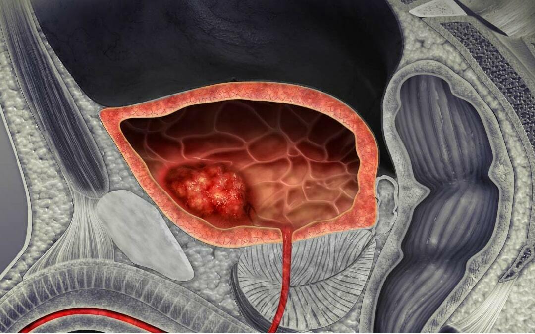 Cáncer y regulación del ciclo celular