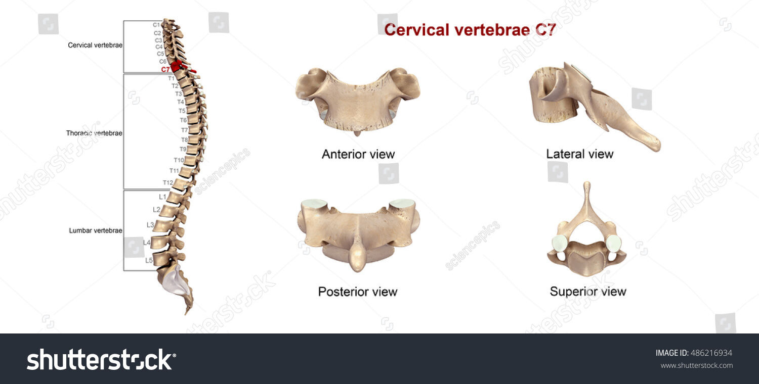 OSTEOMUSCULAR DEL CUELLO