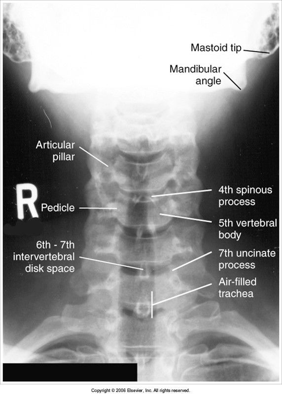 Unit 7 - Cranium and Vertebral Column