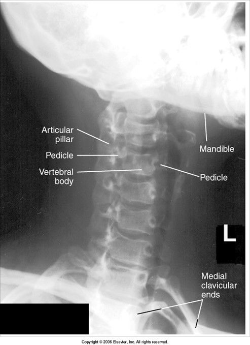 rotation to the left