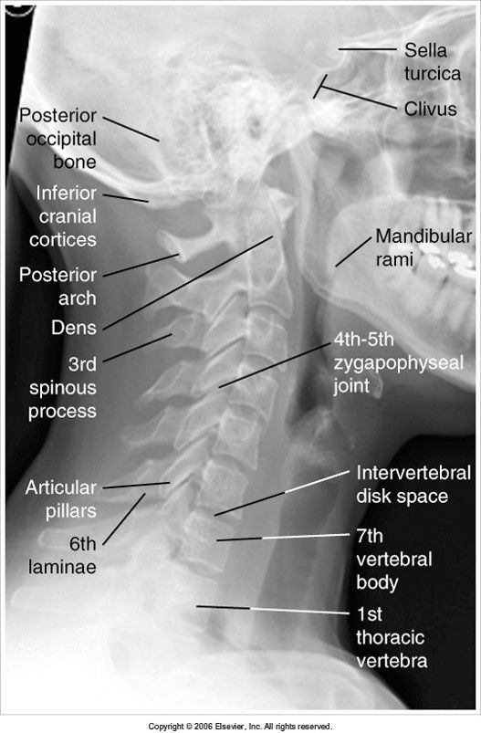 Lateral C-Spine evaluation criteria