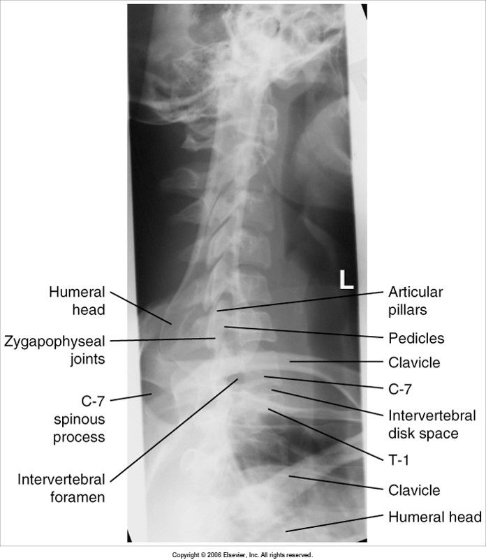 Swimmer's Lateral T-Spine Evaluation Criteria