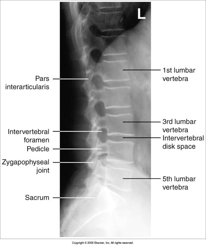 Lateral Lumbar evaluation criteria