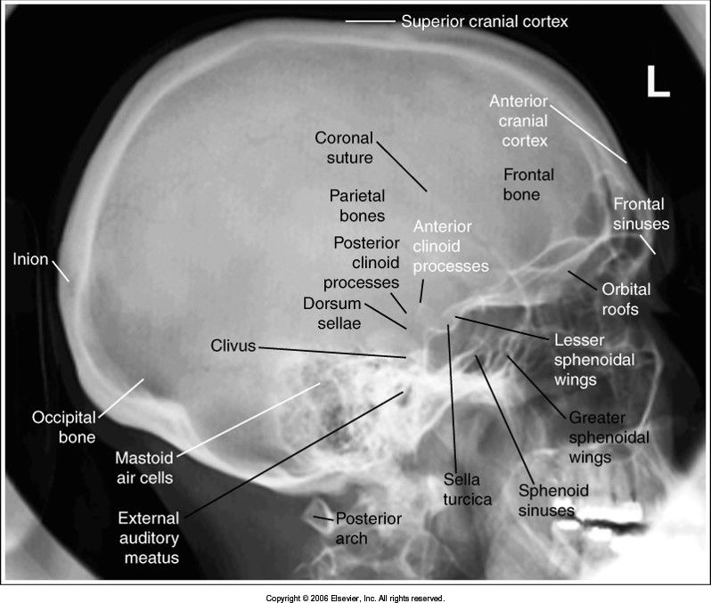 Lateral Skull evaluation criteria