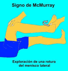 SEMIOLOGIA RODILLA Y TOBILLO