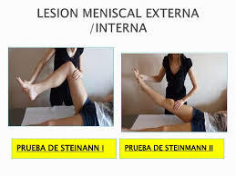 SEMIOLOGIA RODILLA Y TOBILLO