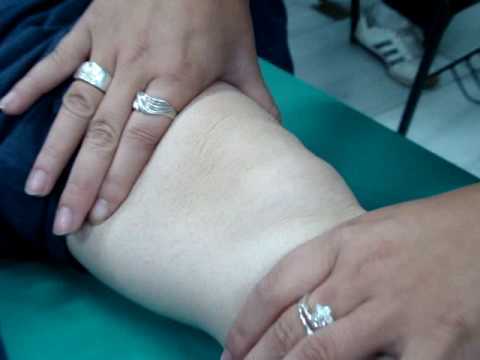 SEMIOLOGIA RODILLA Y TOBILLO