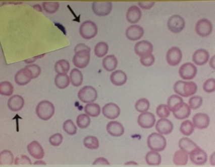 HEMetology cell ID
