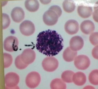 Basophil