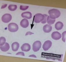 schistocyte