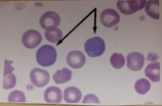polychromataphil