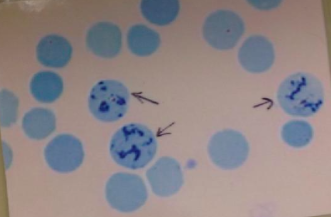reticulocyte