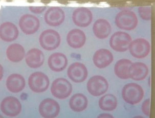 target cells