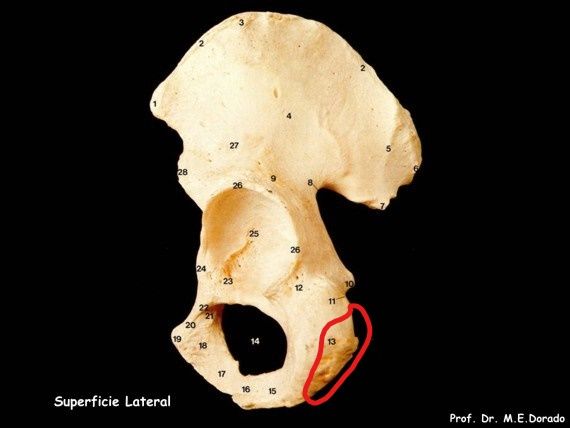 Señale la tuberosidad isquiática